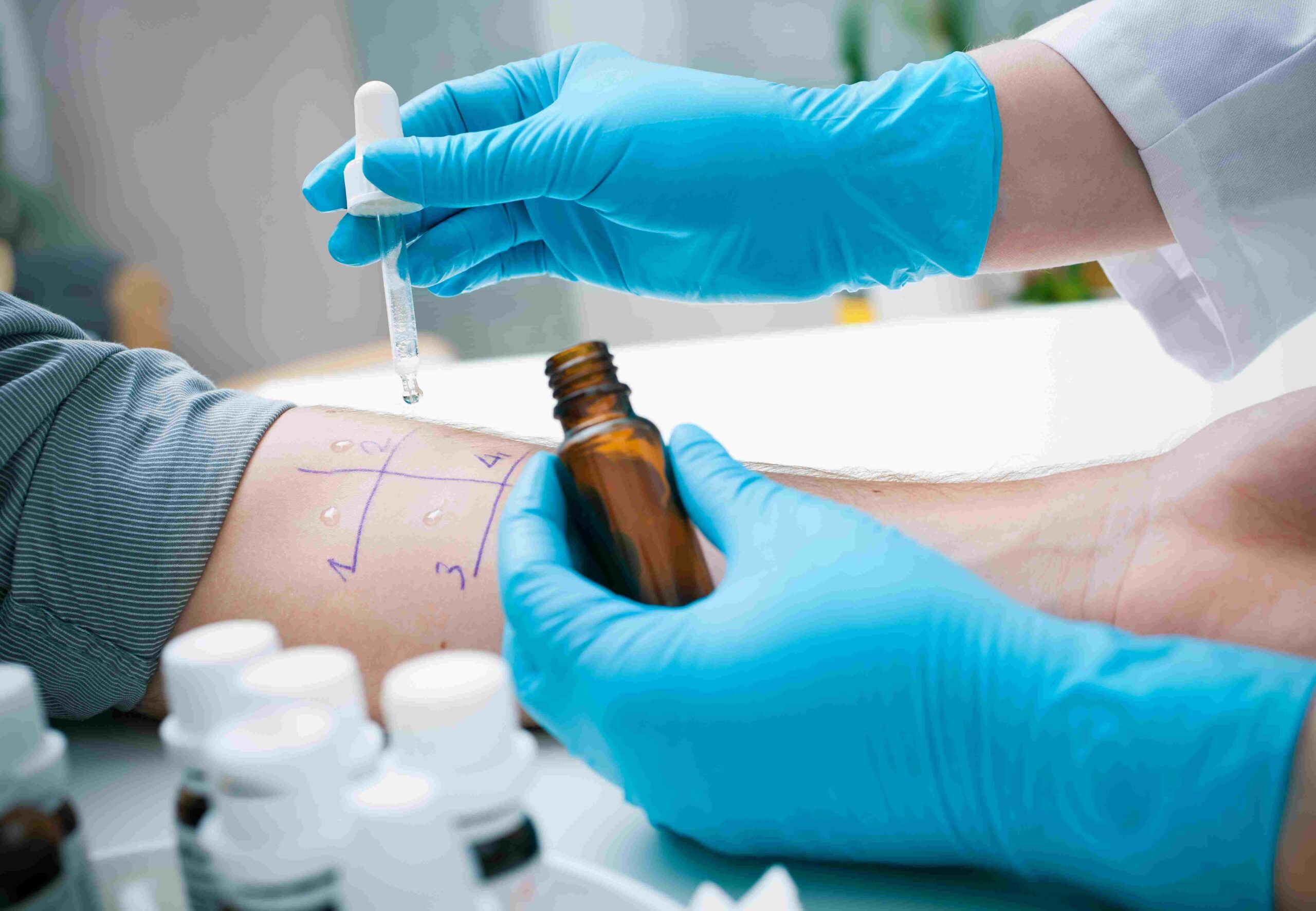 Echte Lebensmittelallergien durch Aromen treten äußerst selten auf